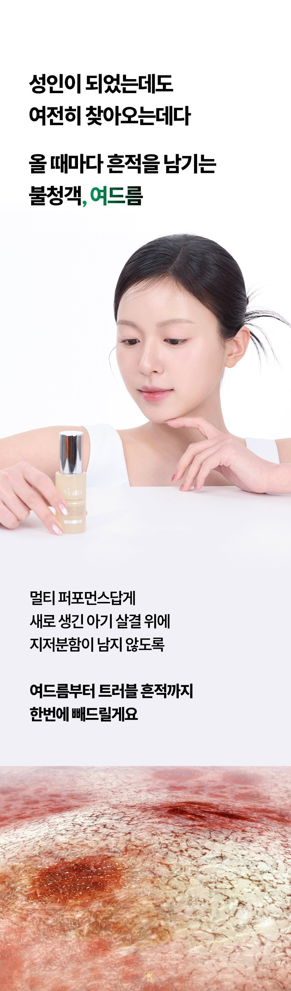 토타덤 피톡스 앰플