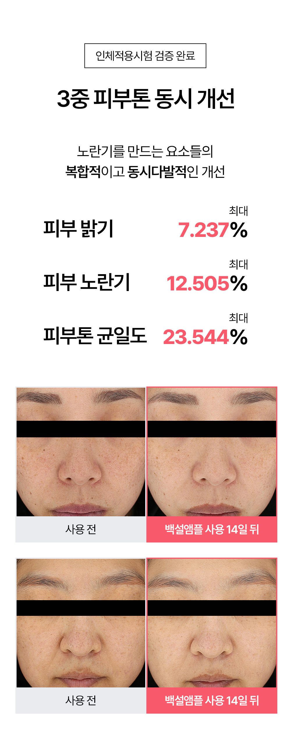 빗결 백설 앰플