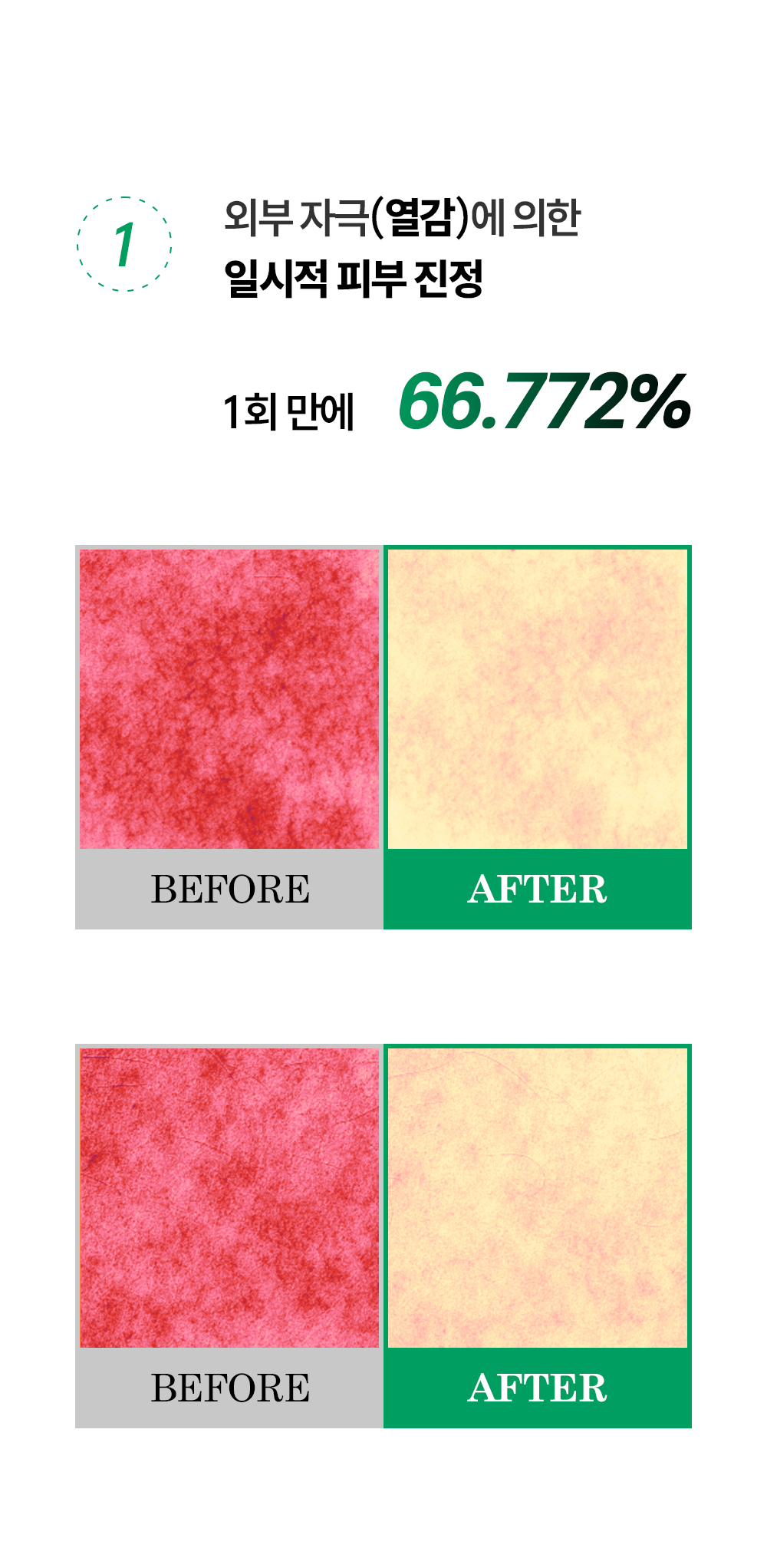 토타덤 피톡스 앰플
