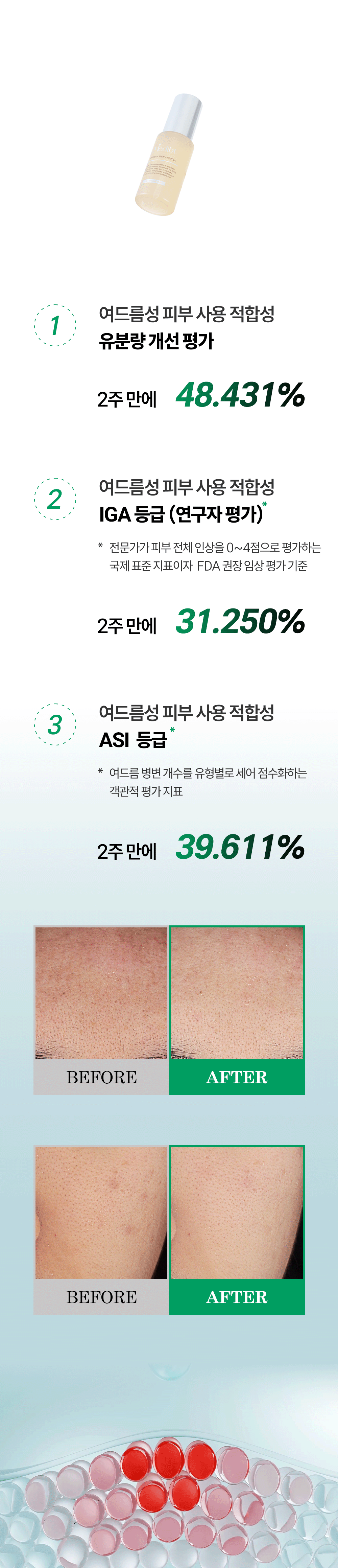 토타덤 피톡스 앰플