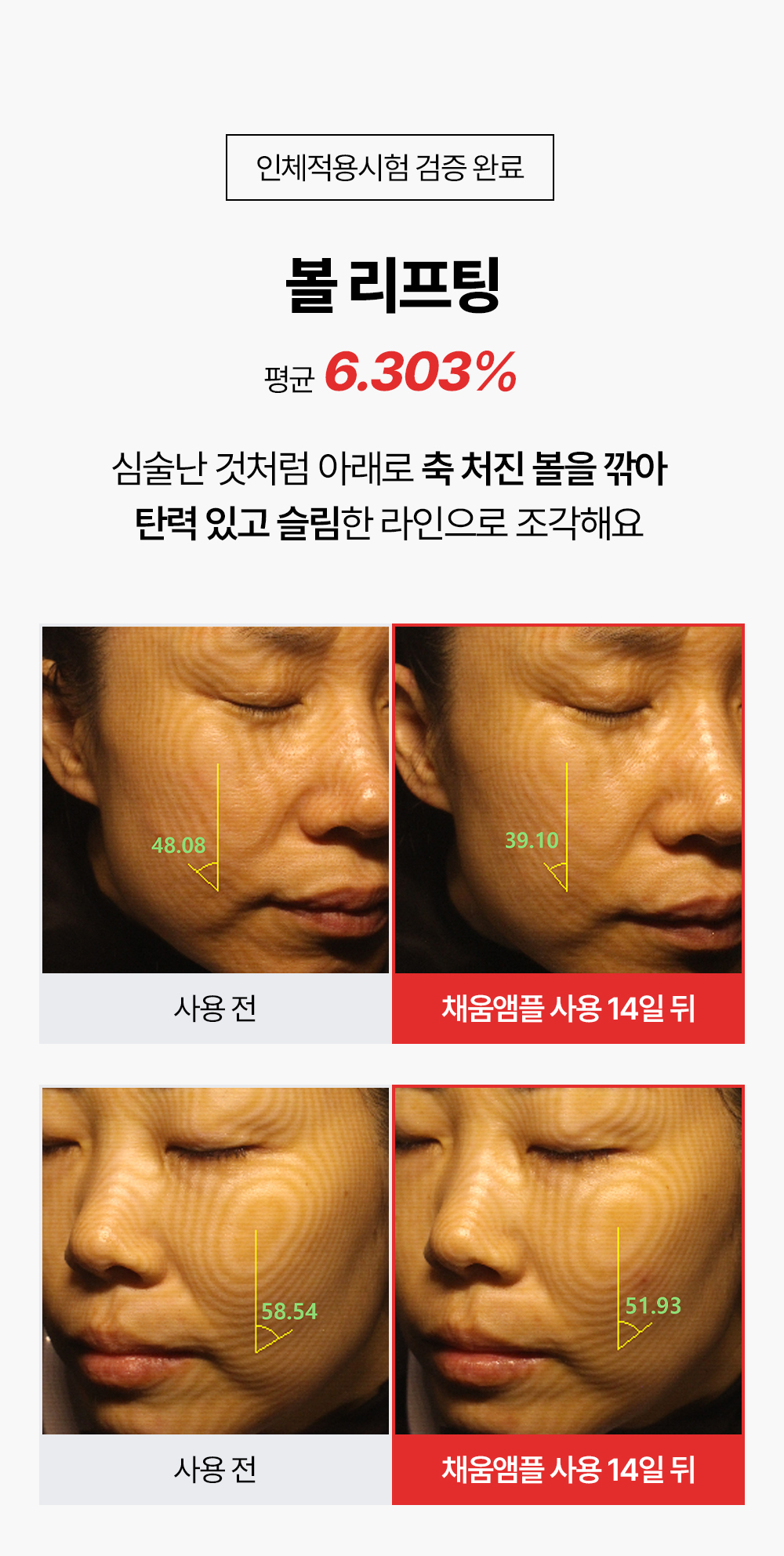 레티노이드 빗결 채움 앰플