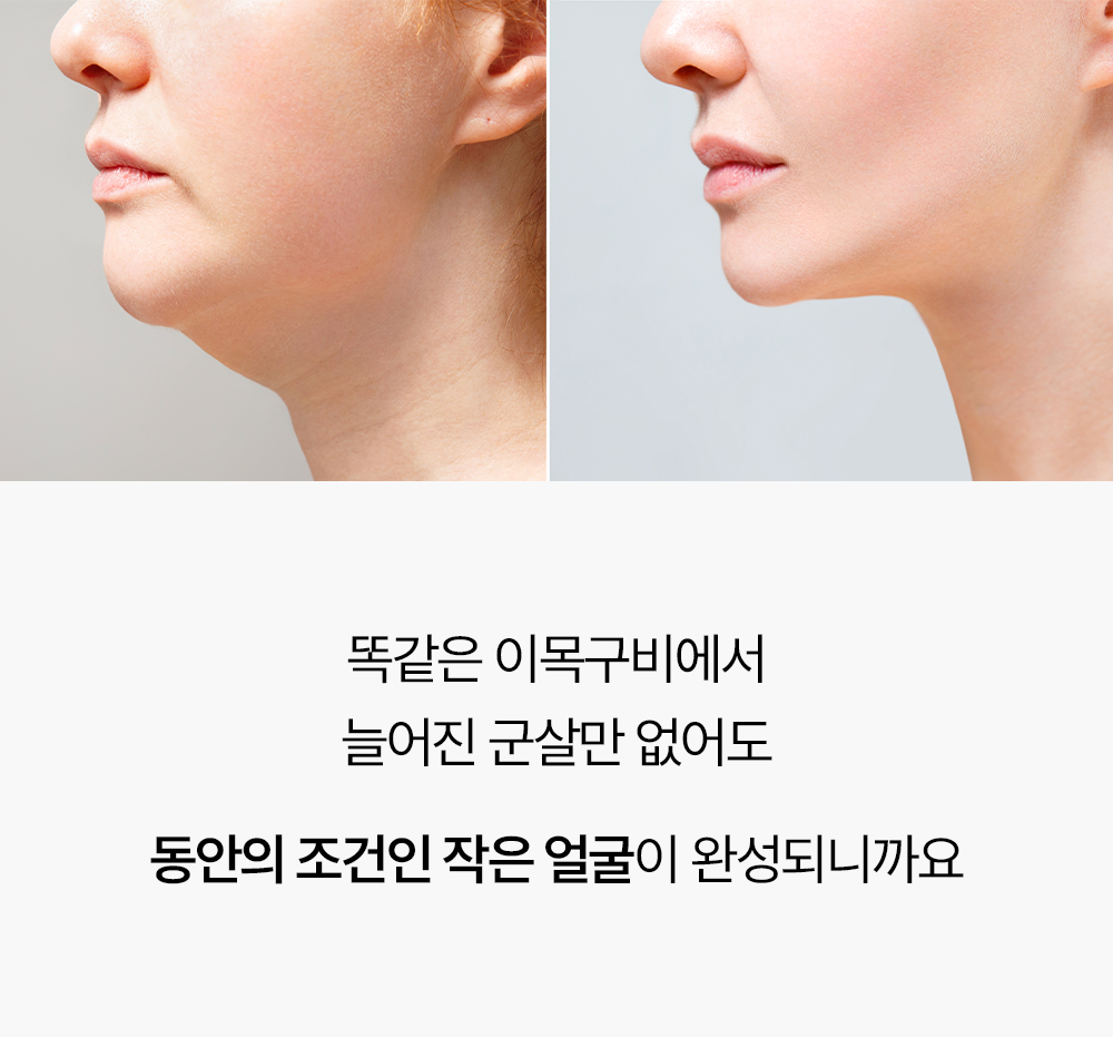 레티노이드 빗결 채움 앰플