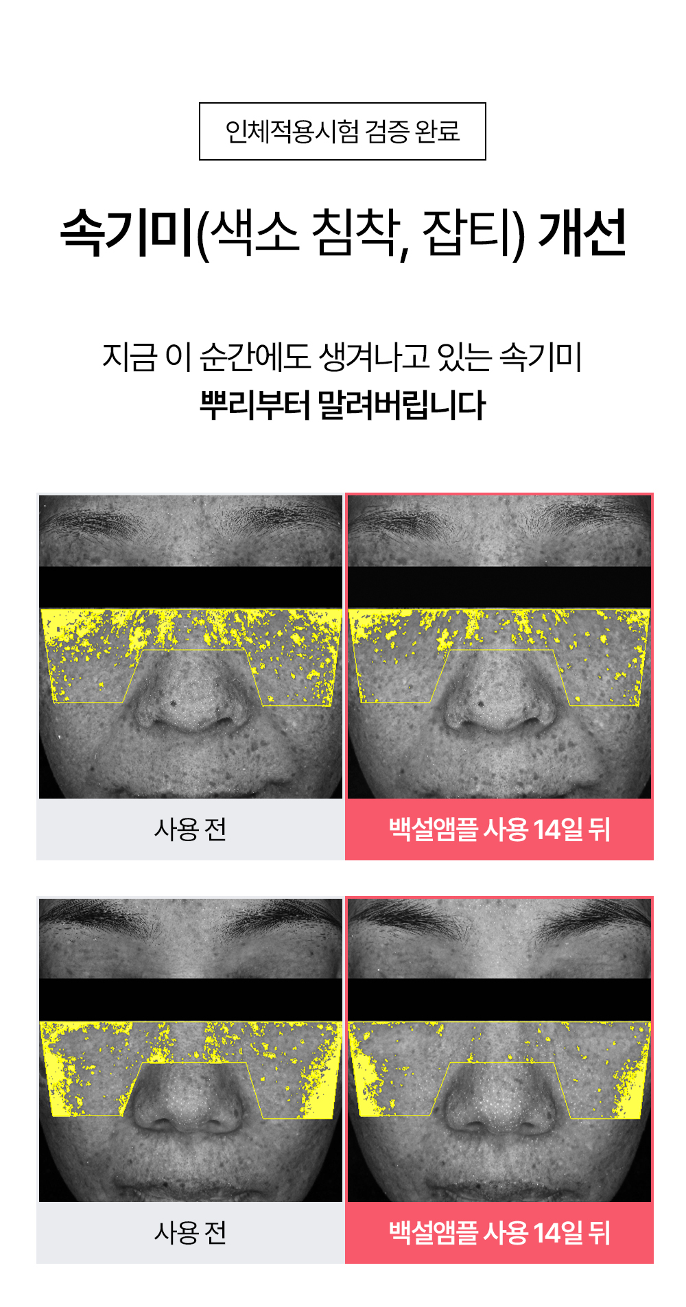 빗결 백설 앰플