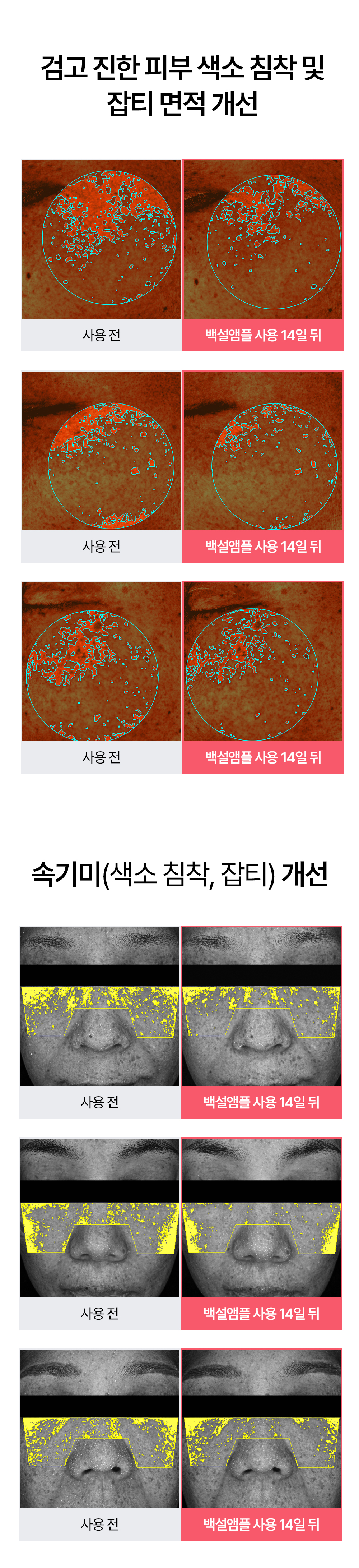 빗결 백설 앰플