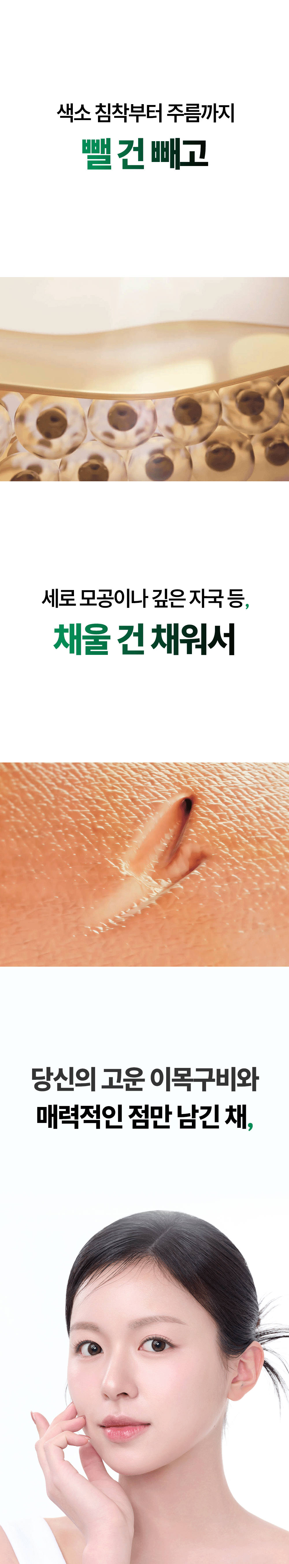 토타덤 피톡스 앰플