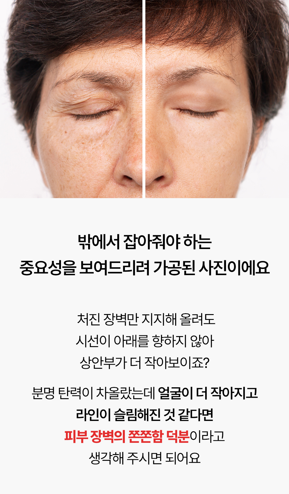 레티노이드 빗결 채움 앰플