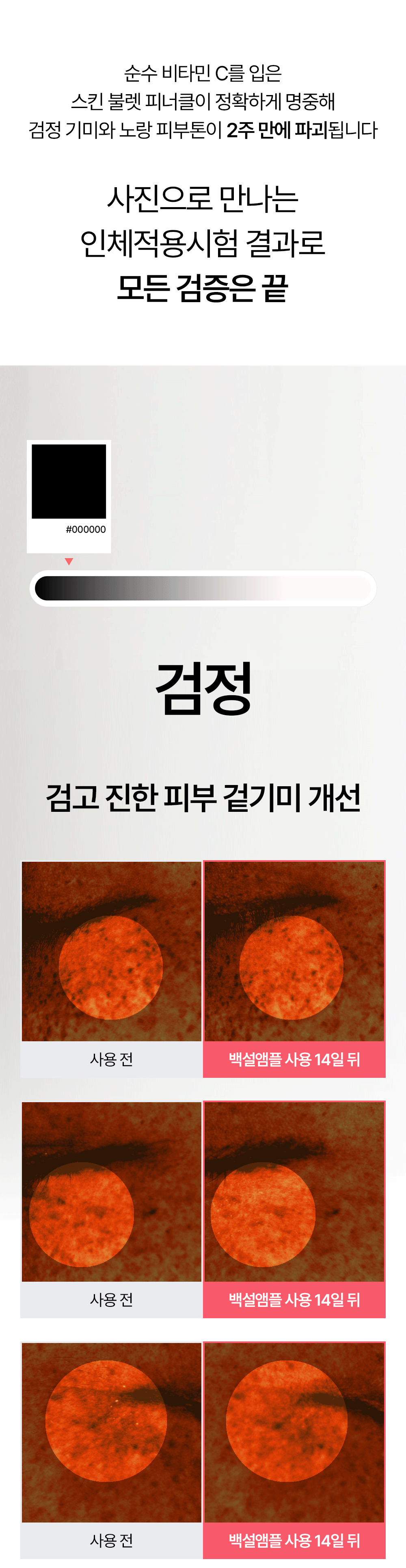 빗결 백설 앰플