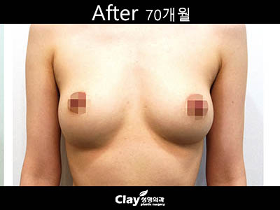 b3cd16a3fab95.jpg