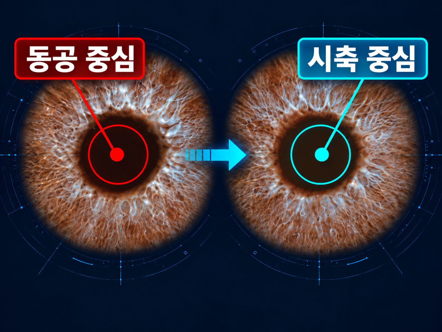 시축 중심 보정