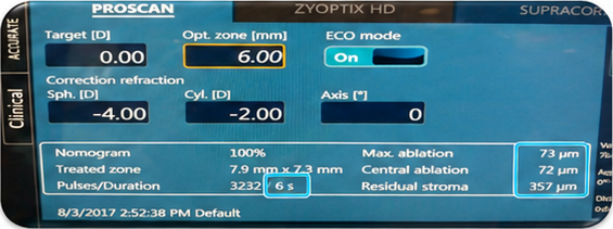 TENEO 317 M2 치료계획 화면 - 근시 -4.00D 난시 -2.00D