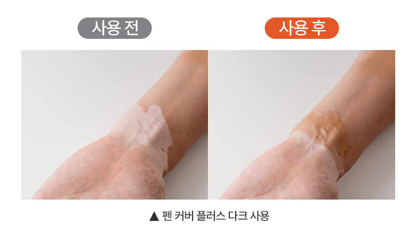 펜 커버 플러스 5g
