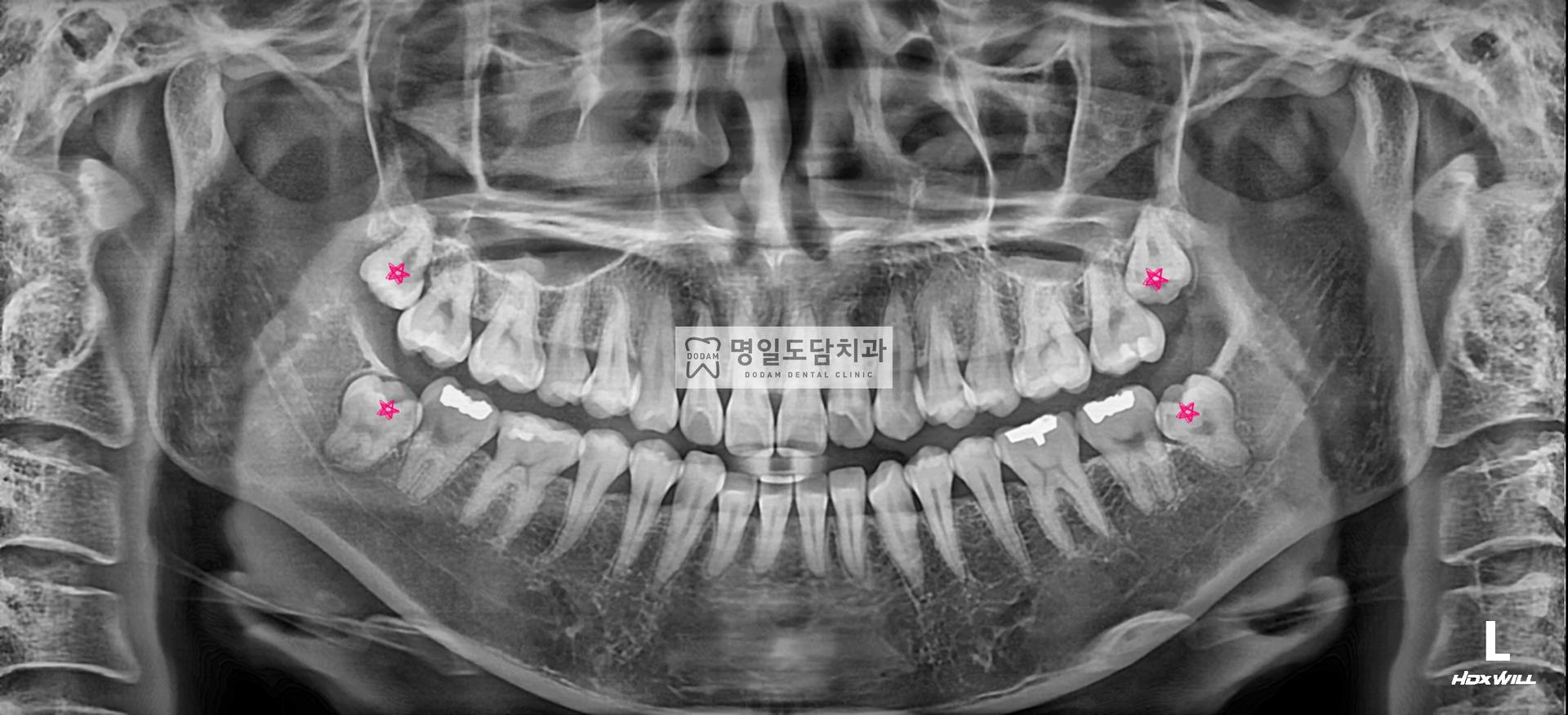 2cf8ca785d161.jpg