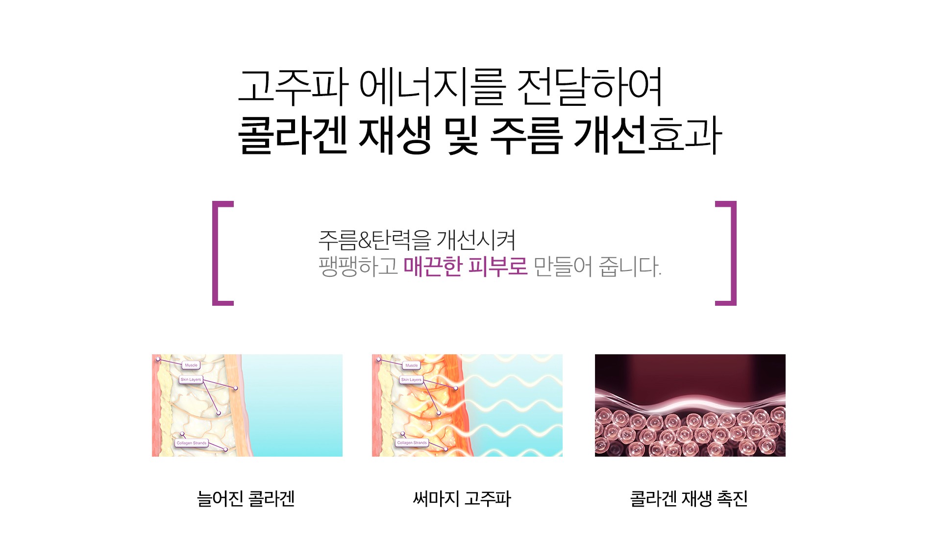 써마지 원리 마곡피부과 닥터에버스