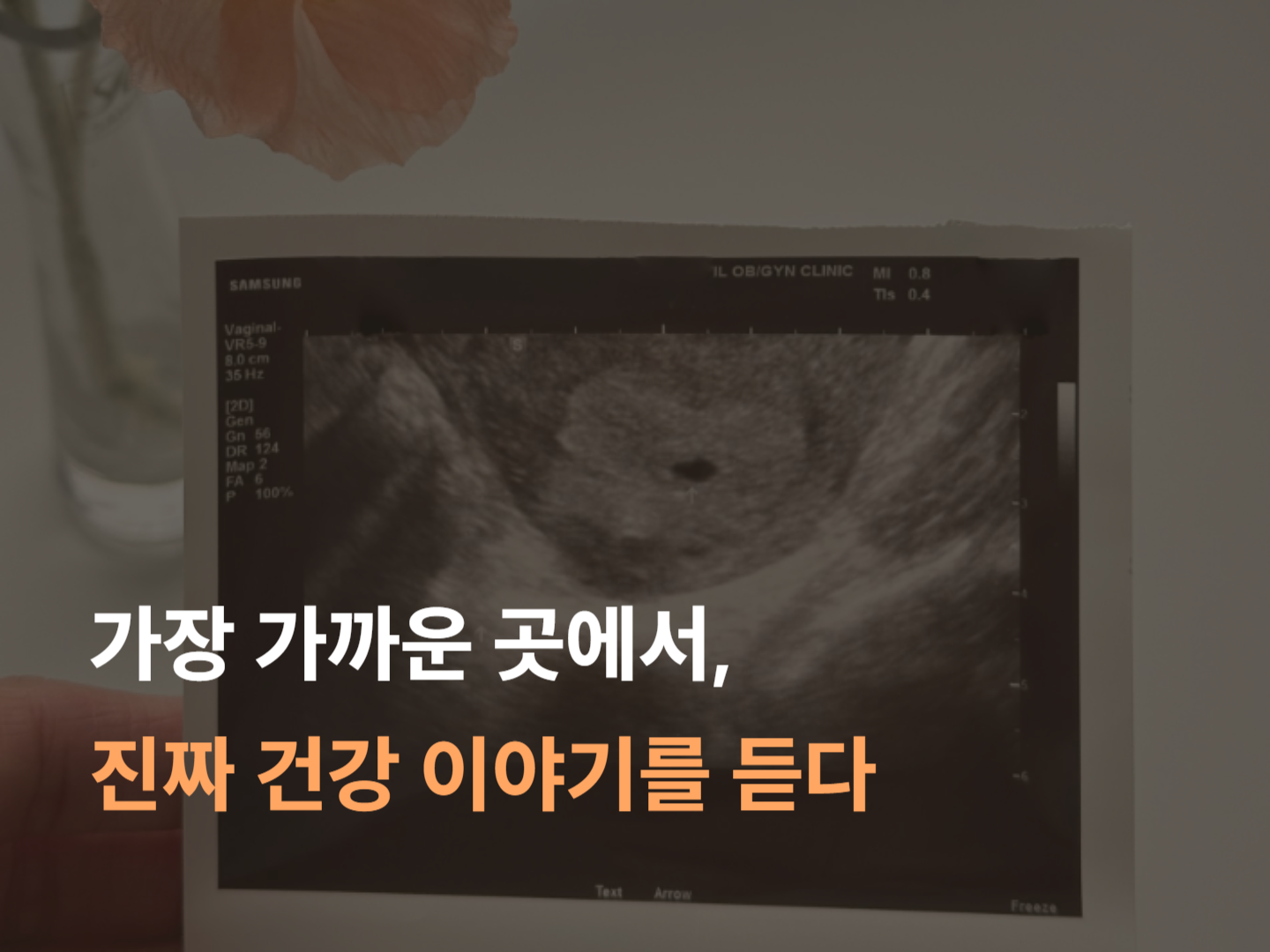 95a695648688e.png