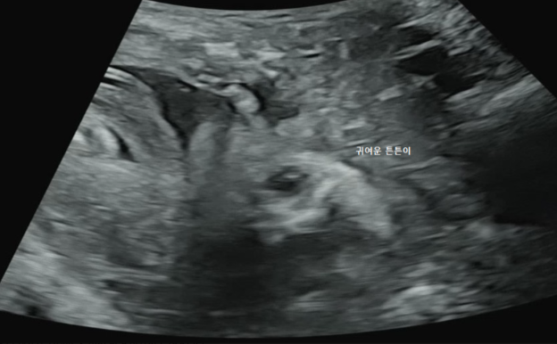 a0ec3324c5417.png