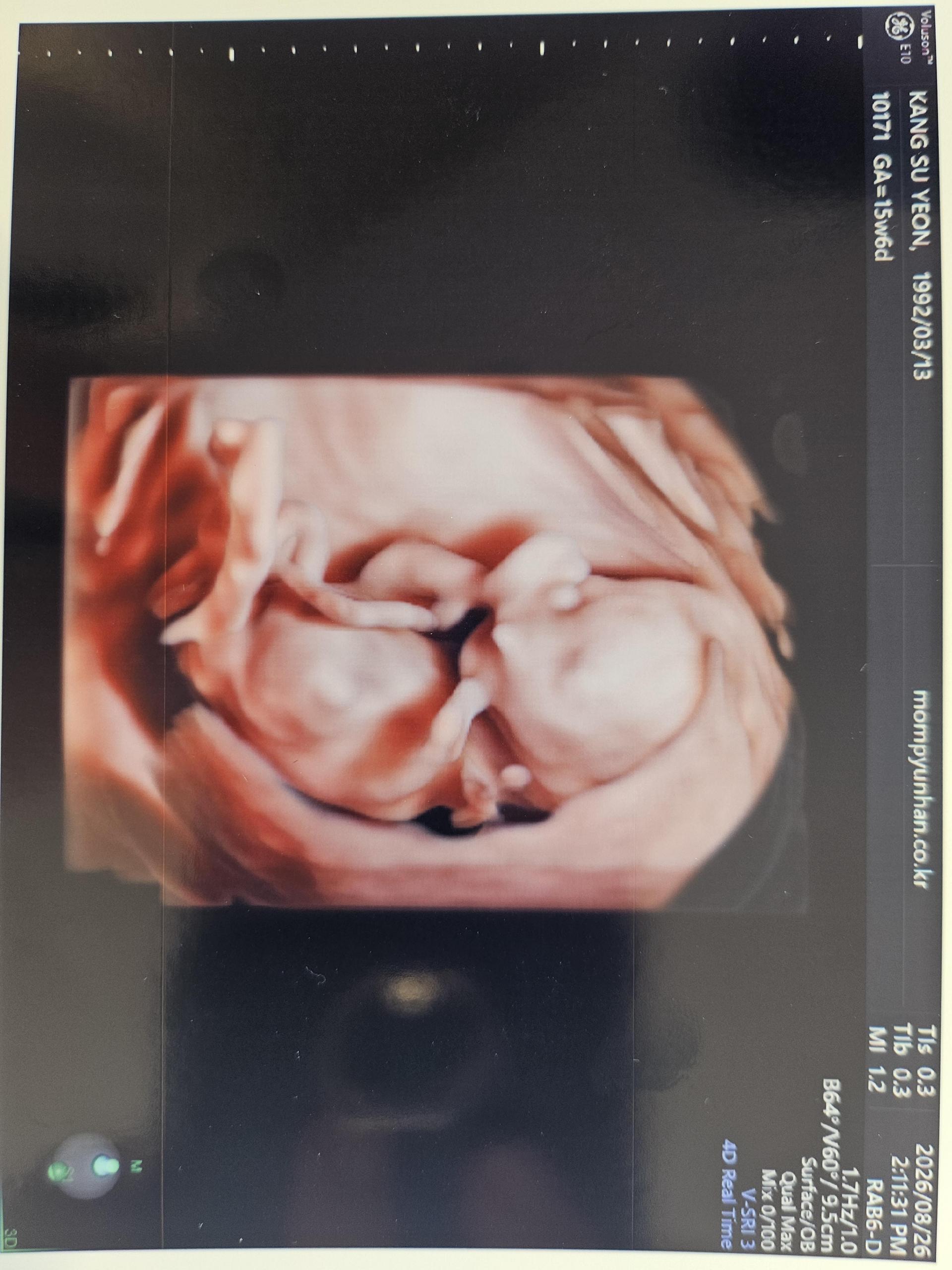d39ecd947a793.jpg