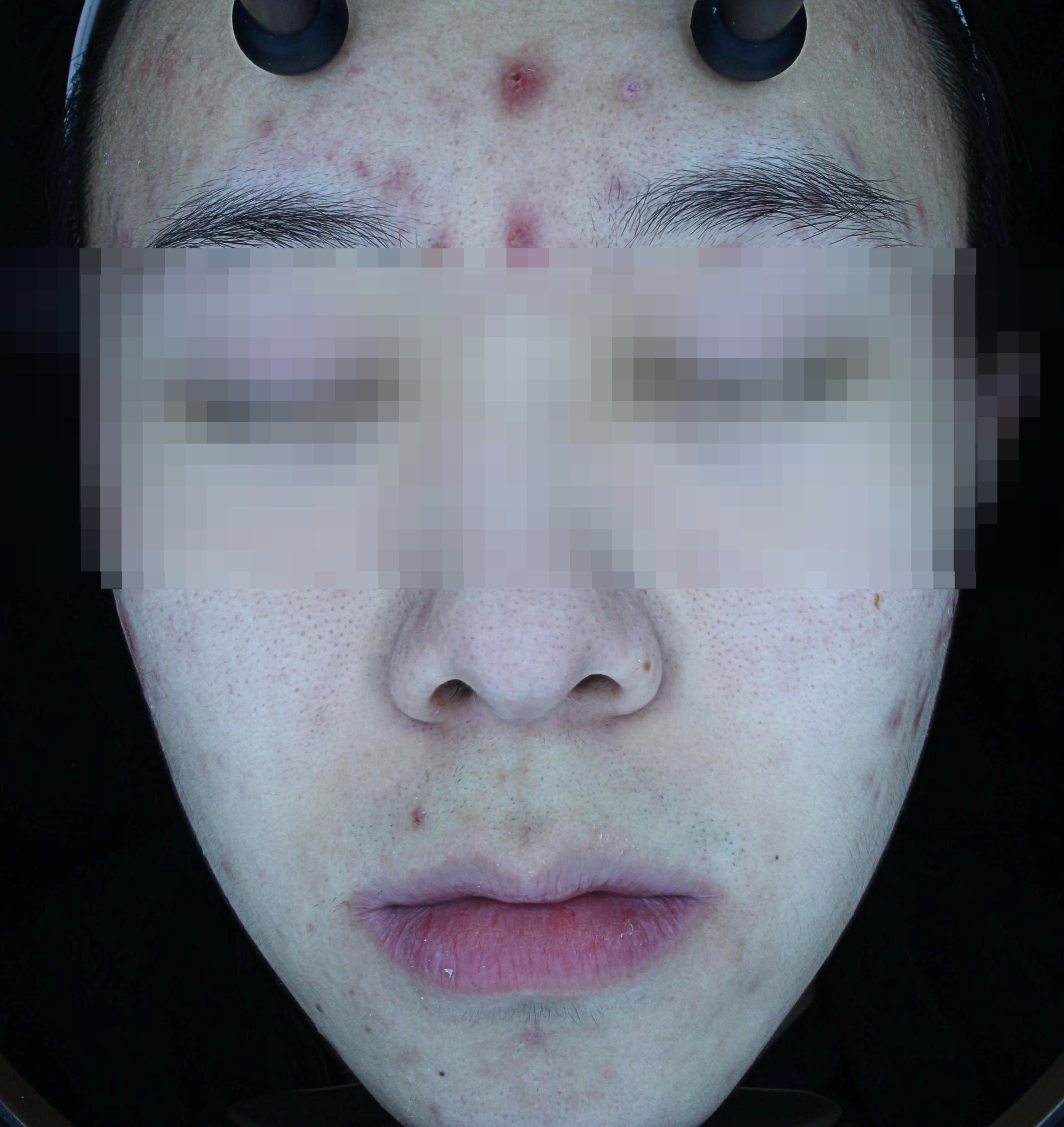 098d3387867cf.png