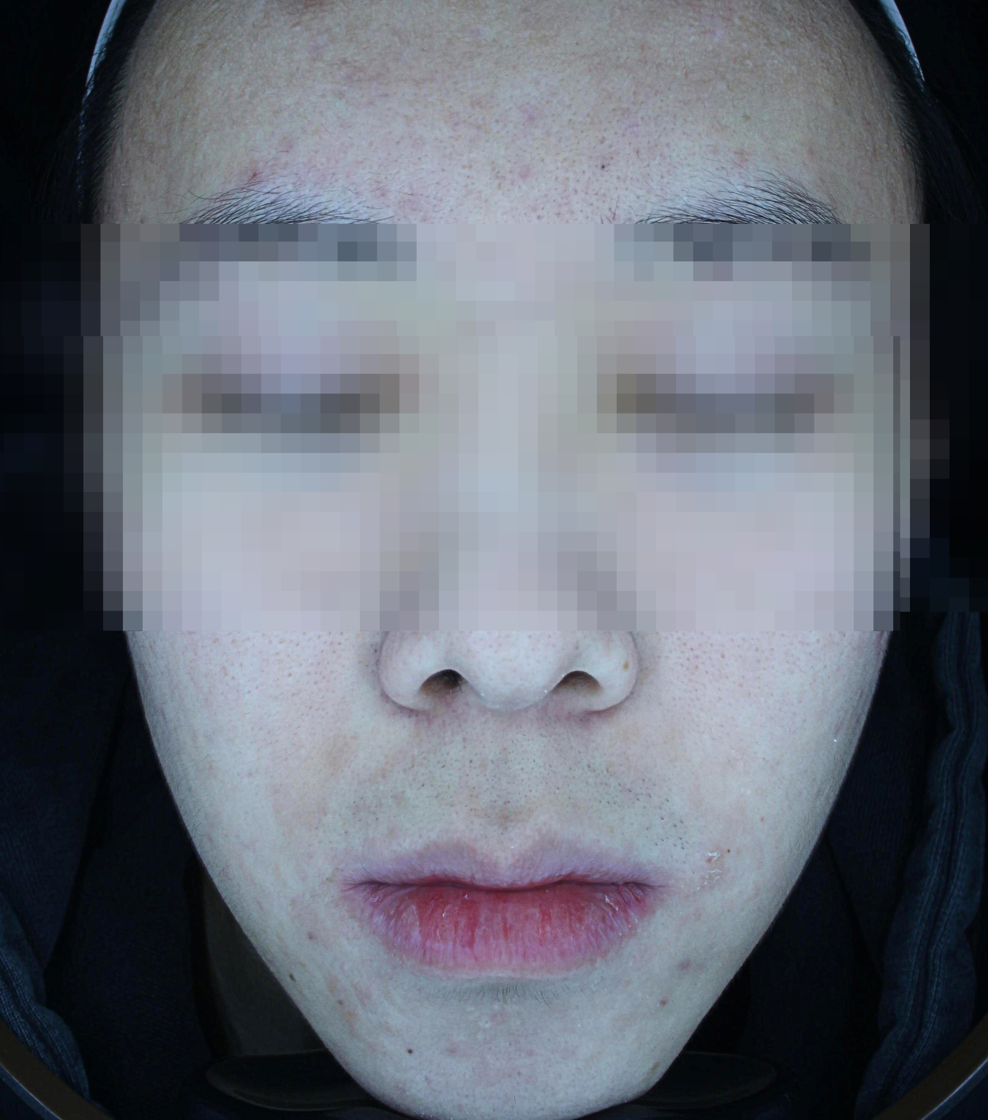 799042c76efce.png