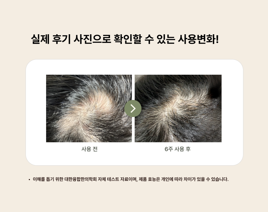 리모정M (홈케어용)