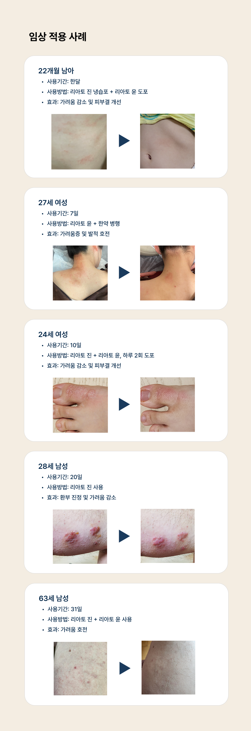 리아토 진(30ml) 5개