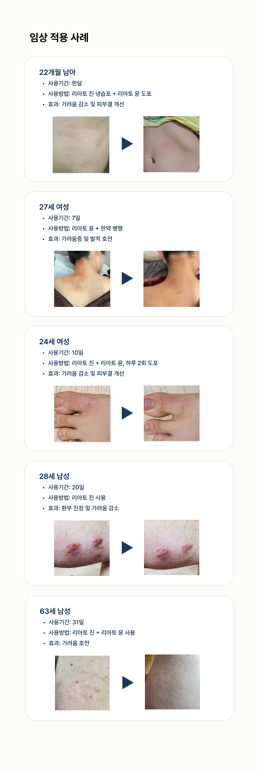 리아토 진(30ml) 5개