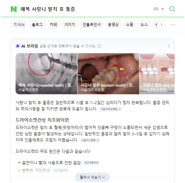 AI가 컨텐츠들을 요약한 내용을 검색 상단에 보여주고 있는, 네이버 스니펫