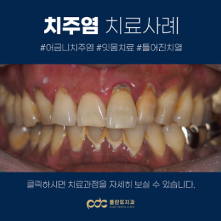 7645f2c2b4e35.jpg