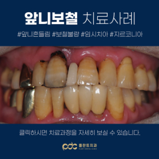 98d575c4ca6c5.jpg