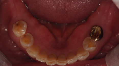 cdb82e942b657.png