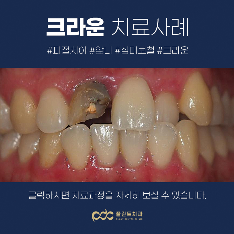 fa10b3a9469b0.jpg