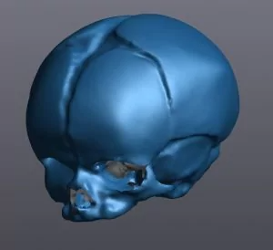 VXmodel에서 인간 두개골의 블루 3D 스캔