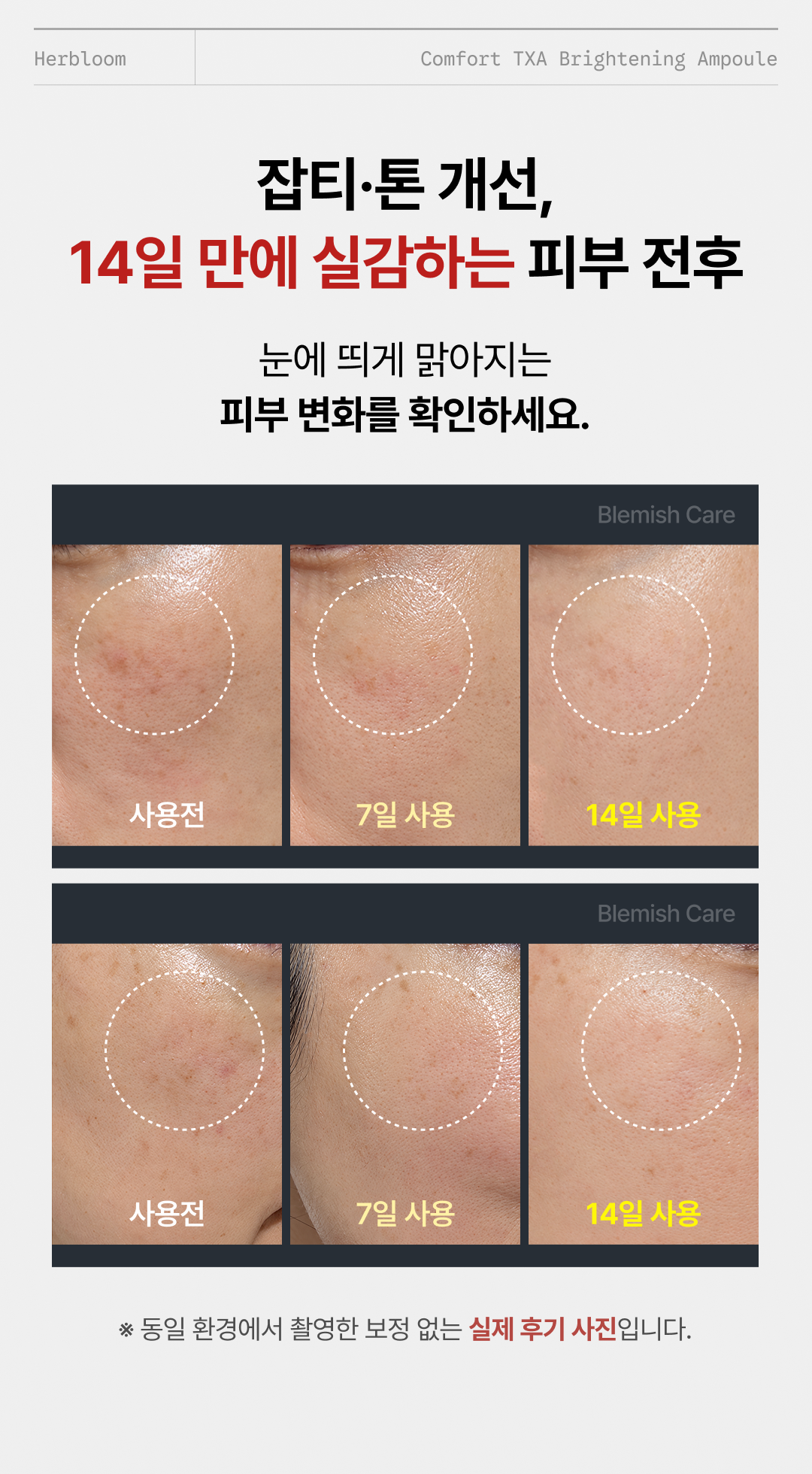 컴포트 트라넥삼산 브라이트닝 앰플