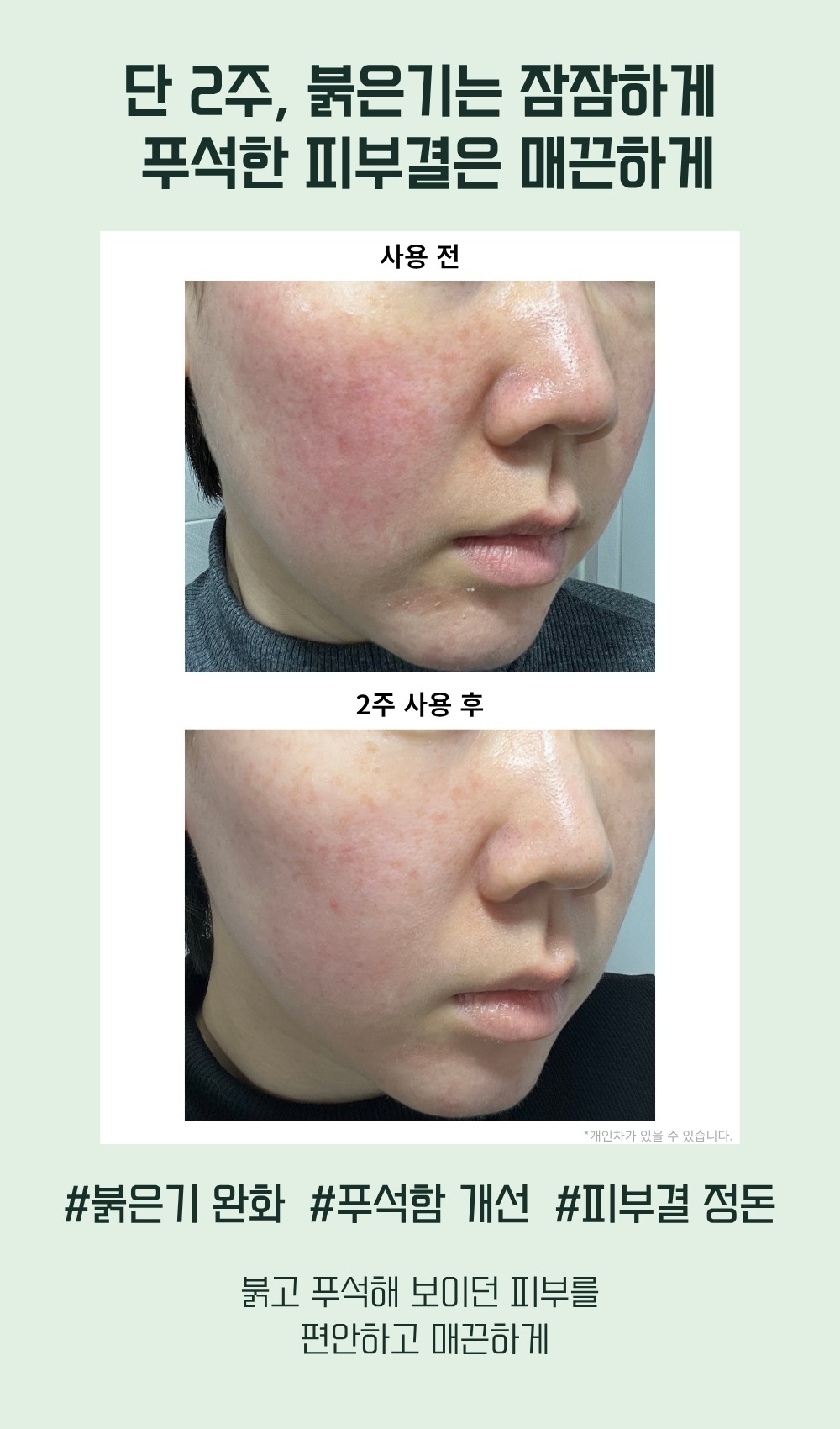 [2개] 시카 PDRN 플럼핑 진정 세럼 💜PDRN 탄력💜