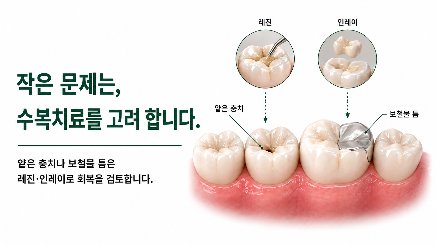c996b18a6e312.png