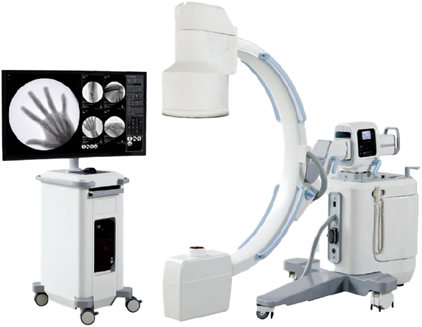 C_arm_fluoroscopy