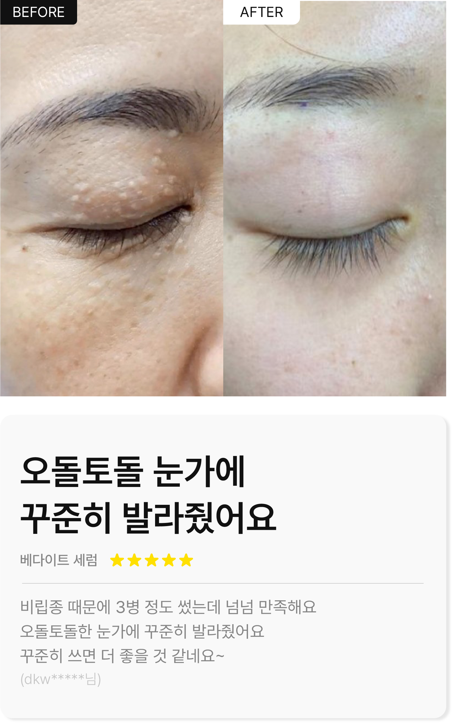 베다이트 세럼 모바일