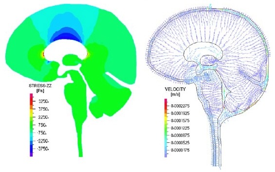 brain_fig12.jpg