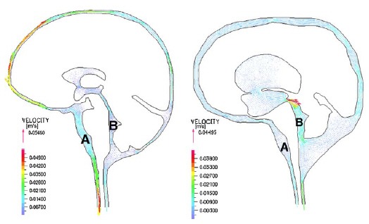 brain_fig7.jpg