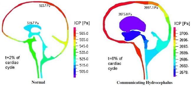 brain_fig8c.jpg