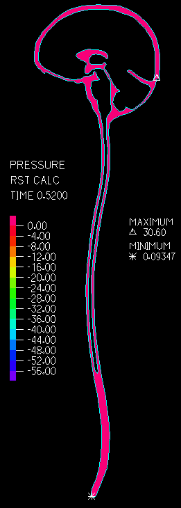 c85faf84d6987.gif