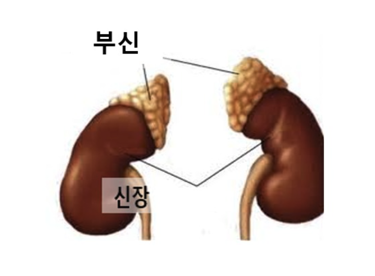 만성피로 간때문?
