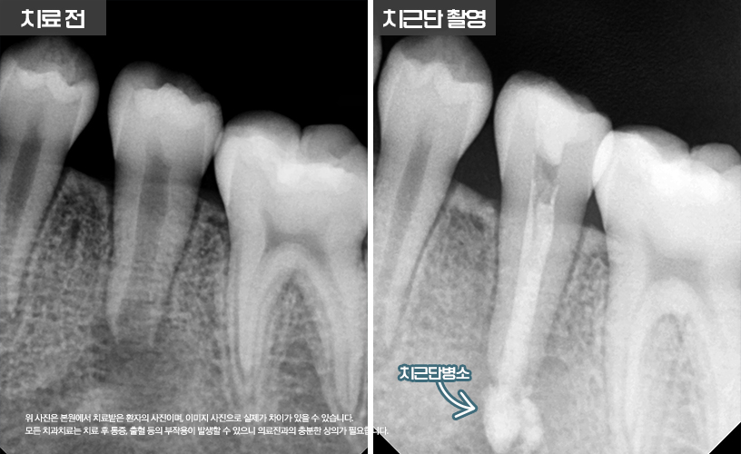 6137fe9689406.jpg