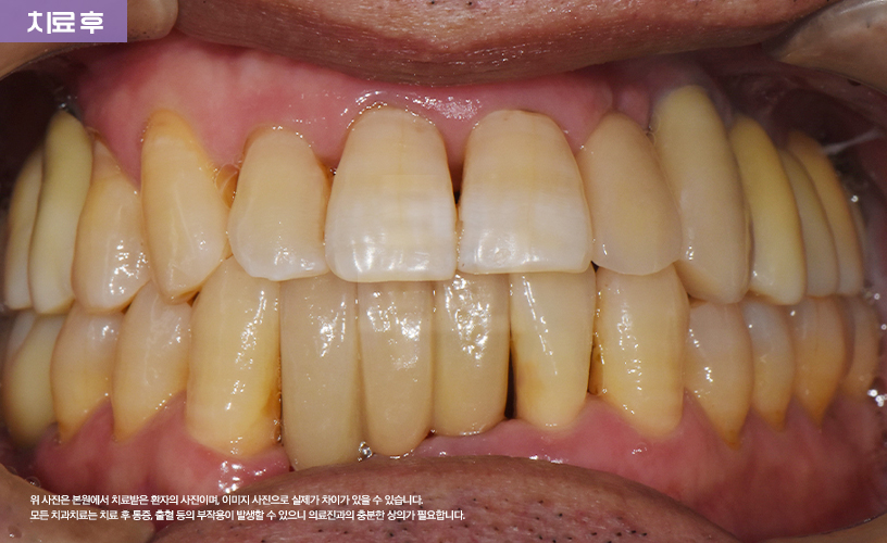 ca8661a889255.jpg