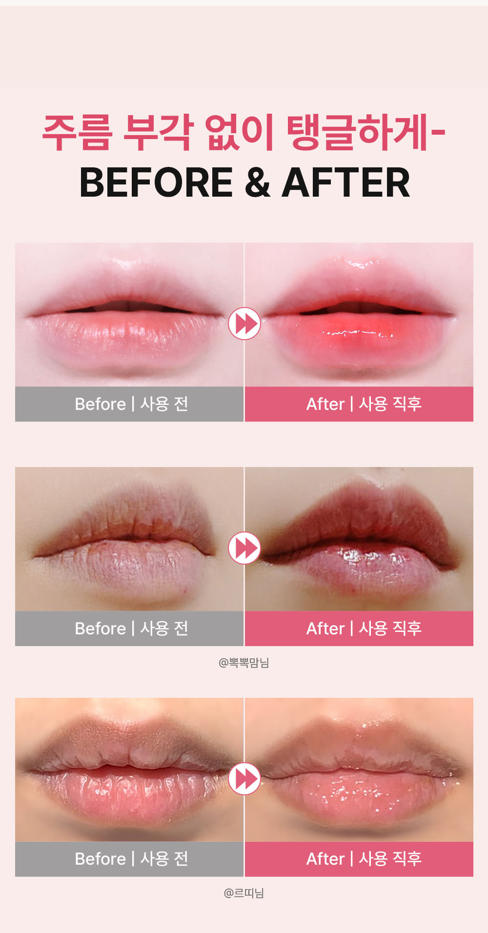 플럼핑 립케어 전후 비교 이미지, 얇고 건조한 입술이 탱글하고 건강한 립 볼륨으로 변화
