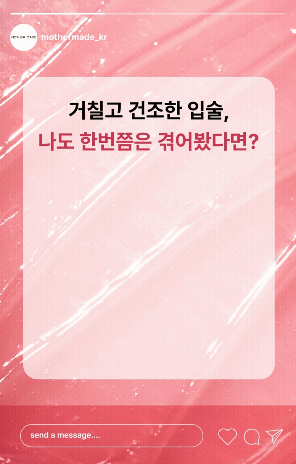 왜 입술이 건조하고 각질이 생길까? 거칠고 갈라진 입술 고민을 보여주는 립케어 문제 상황 이미지