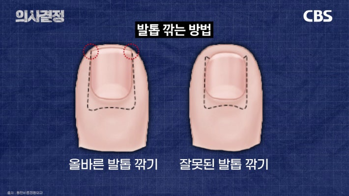 210정형외과의원 최준하 원장. '의사결정' 유튜브 캡처