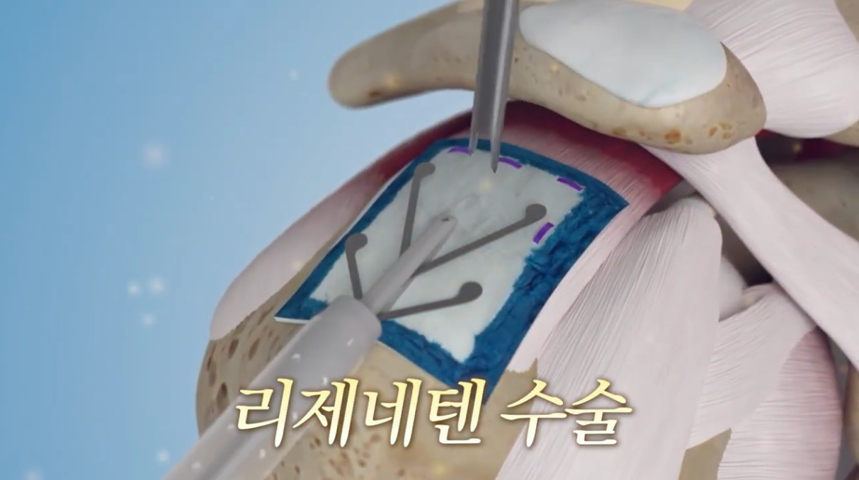 ccfe7d750f58a.png