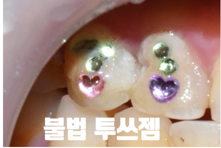투쓰젬5.png