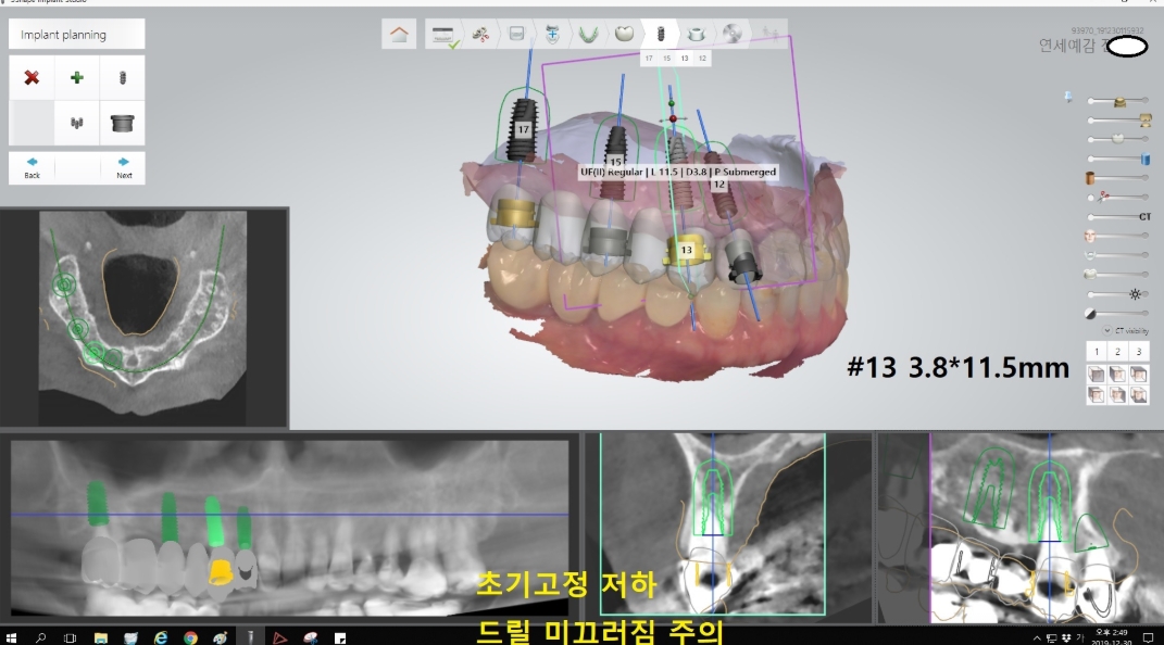 모의시술5.jpeg