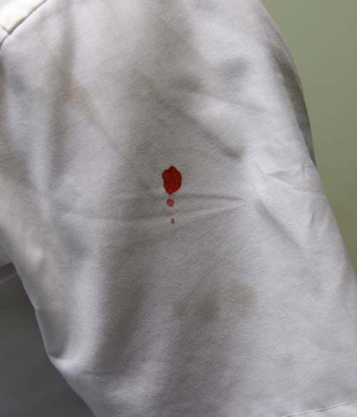 2006년 7월 1일 마카오에서 순례오신 신부님의 팔 상단부분에 향유와 성혈을 내려주심